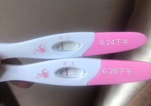 细数卵巢脓肿和囊肿的区别，正确治疗很重要