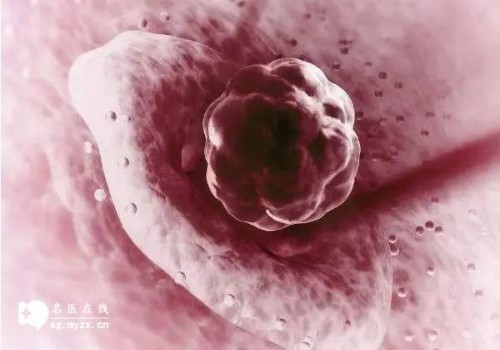 广州供精试管：卵巢早衰怎么补救，冻卵技术帮您保留生育能力